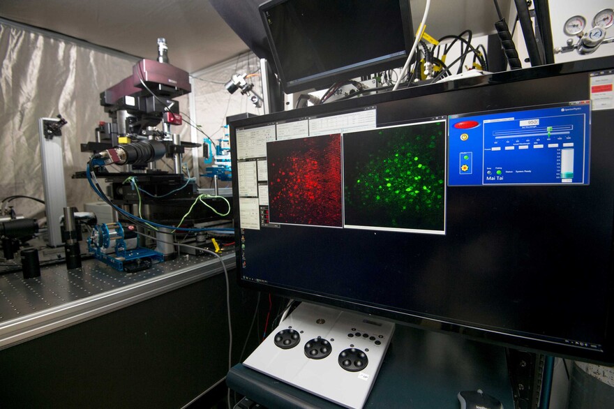 The Faculty has built the Hong Kong’s first in vivo multiphoton microscope dedicated to the study of cerebral small vessel disease. It will enhance the fundamental understanding of the underlying pathogenesis, the knowledge of which is crucial for the future development of novel therapeutics that can delay disease progression.
